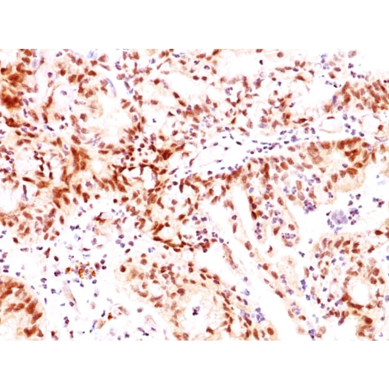 Immunohistochemistry - Anti-Estrogen Receptor beta 1 Antibody [ERb455] - BSA and Azide free (A251672) - Antibodies.com