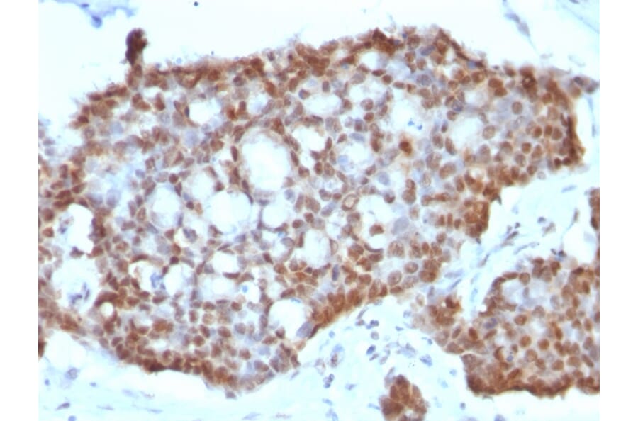 Immunohistochemistry - Anti-Estrogen Receptor beta 1 Antibody [ERb455] - BSA and Azide free (A251672) - Antibodies.com