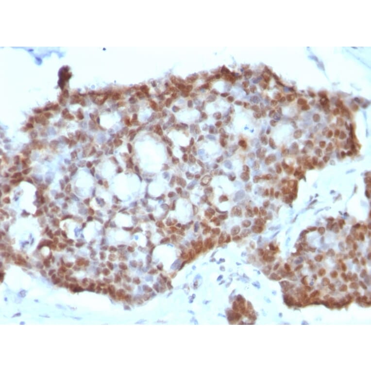 Immunohistochemistry - Anti-Estrogen Receptor beta 1 Antibody [ERb455] - BSA and Azide free (A251672) - Antibodies.com