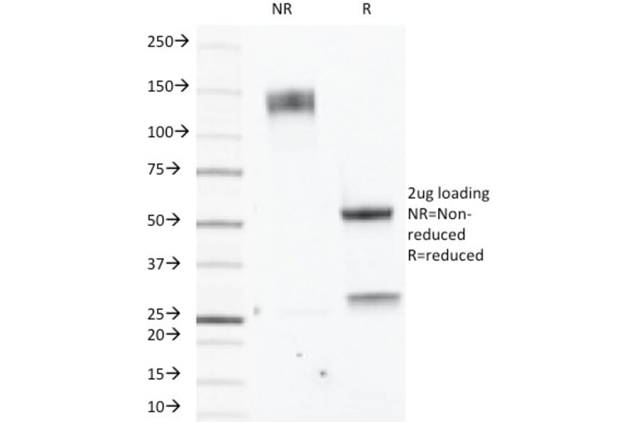 SDS-PAGE - Anti-Estrogen Receptor beta 1 Antibody [ERb455] - BSA and Azide free (A251672) - Antibodies.com