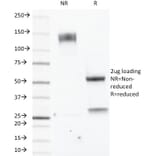 SDS-PAGE - Anti-Estrogen Receptor beta 1 Antibody [ERb455] - BSA and Azide free (A251672) - Antibodies.com