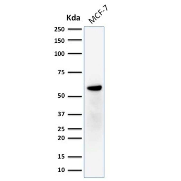 Western Blot - Anti-Estrogen Receptor beta 1 Antibody [ERb455] - BSA and Azide free (A251672) - Antibodies.com