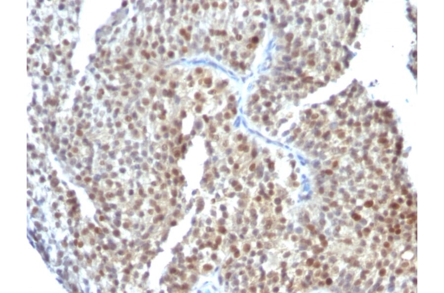 Immunohistochemistry - Anti-Estrogen Receptor beta 1 Antibody [ESR2/686] - BSA and Azide free (A251673) - Antibodies.com