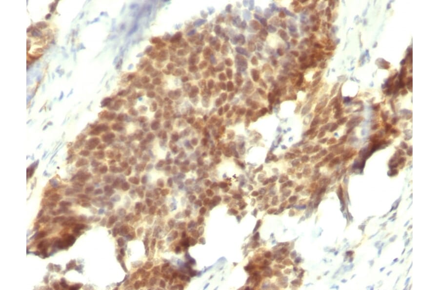Immunohistochemistry - Anti-Estrogen Receptor beta 1 Antibody [ESR2/686] - BSA and Azide free (A251673) - Antibodies.com