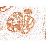 Immunohistochemistry - Anti-Estrogen Receptor beta 1 Antibody [ESR2/686] - BSA and Azide free (A251673) - Antibodies.com