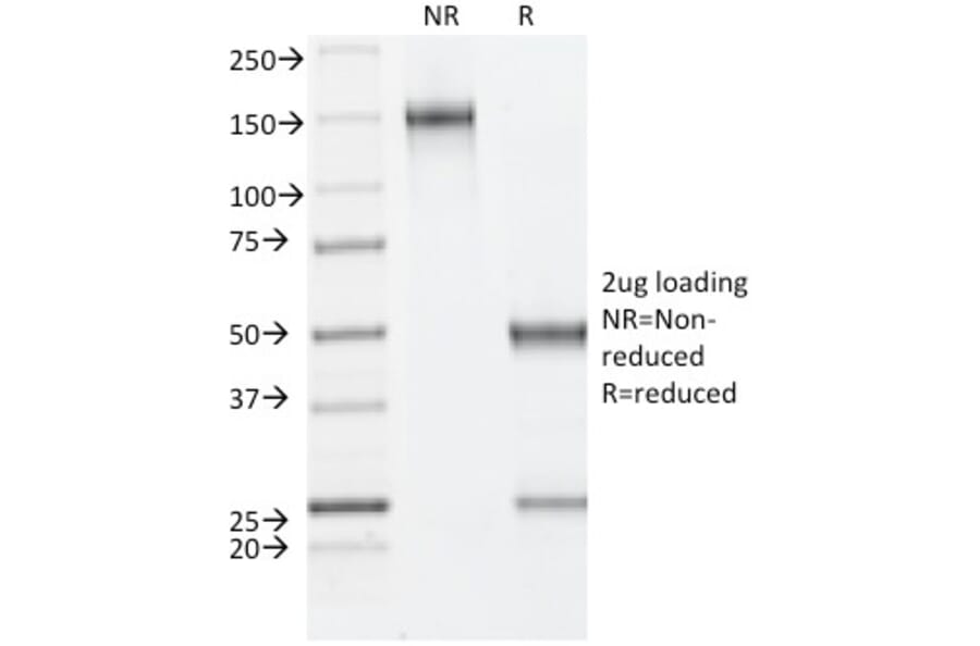 SDS-PAGE - Anti-Estrogen Receptor beta 1 Antibody [ESR2/686] - BSA and Azide free (A251673) - Antibodies.com