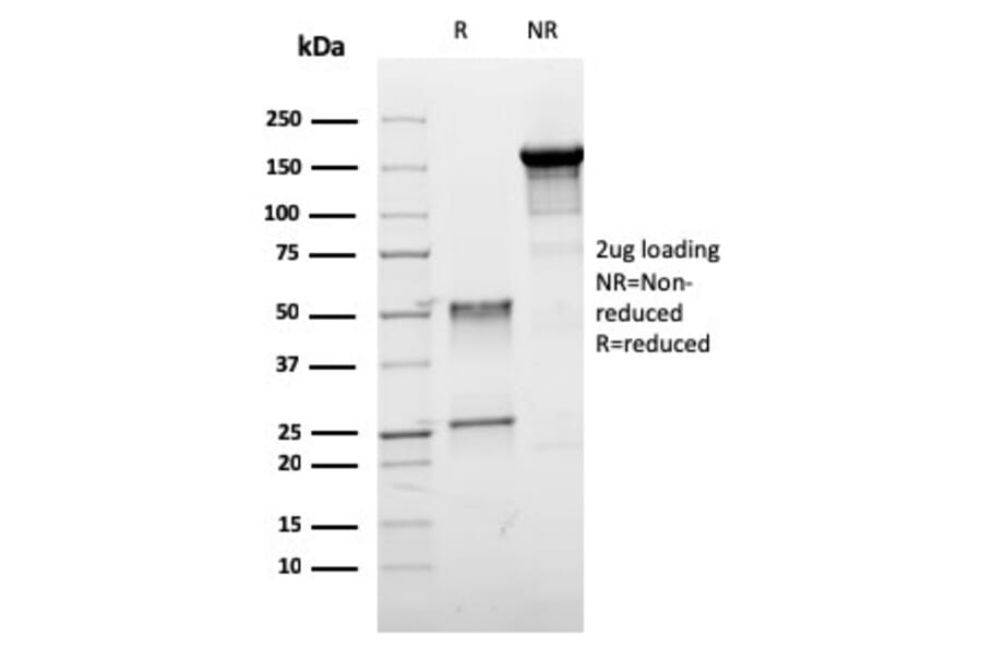 SDS-PAGE - Anti-Estrogen Receptor beta 1 Antibody [ESR2/3005] - BSA and Azide free (A251674) - Antibodies.com