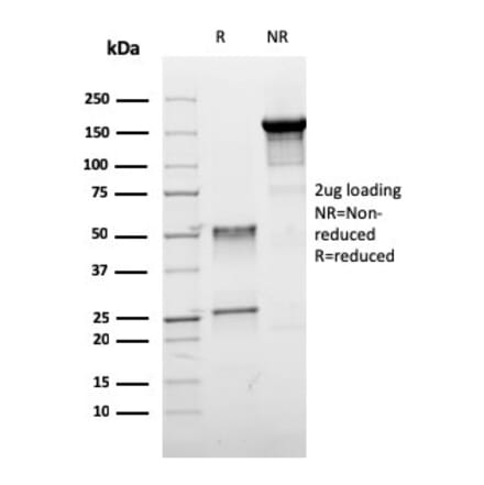 SDS-PAGE - Anti-Estrogen Receptor beta 1 Antibody [ESR2/3005] - BSA and Azide free (A251674) - Antibodies.com