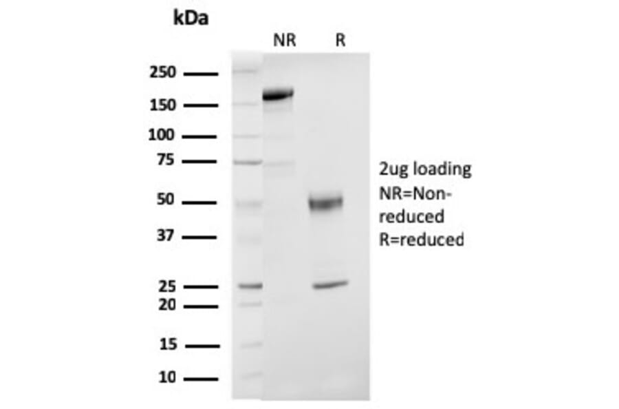 SDS-PAGE - Anti-Estrogen Receptor beta 1 Antibody [ESR2/3207] - BSA and Azide free (A251675) - Antibodies.com