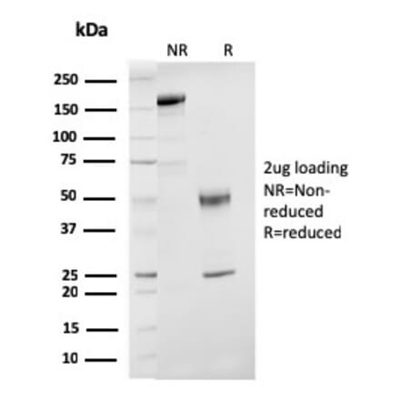 SDS-PAGE - Anti-Estrogen Receptor beta 1 Antibody [ESR2/3207] - BSA and Azide free (A251675) - Antibodies.com