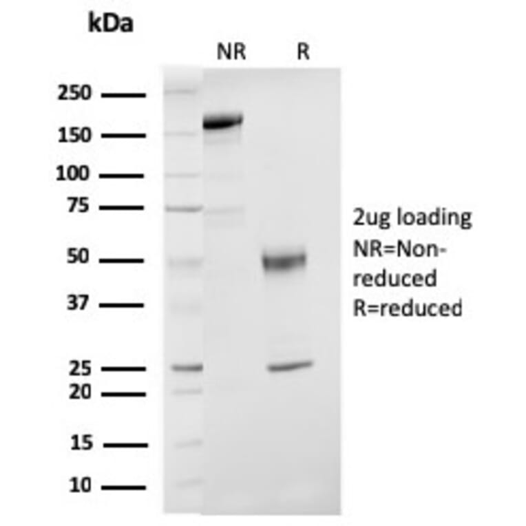 SDS-PAGE - Anti-Estrogen Receptor beta 1 Antibody [ESR2/3207] - BSA and Azide free (A251675) - Antibodies.com