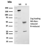 SDS-PAGE - Anti-Estrogen Receptor beta 1 Antibody [ESR2/3207] - BSA and Azide free (A251675) - Antibodies.com