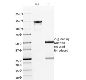 SDS-PAGE - Anti-ETS1 Antibody [ETS1/1801] - BSA and Azide free (A251676) - Antibodies.com