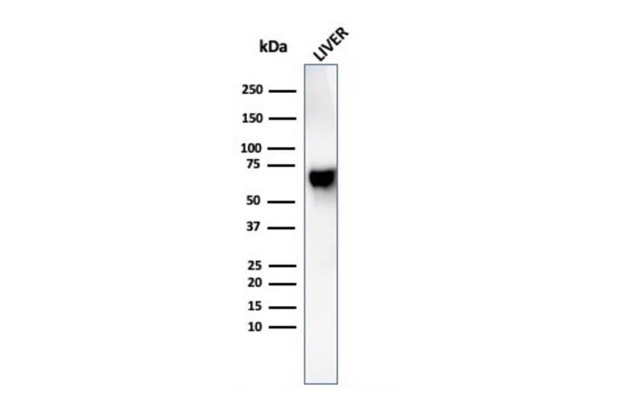Western Blot - Anti-Albumin Antibody [rALB/6410] - BSA and Azide free (A251677) - Antibodies.com