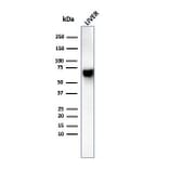 Western Blot - Anti-Albumin Antibody [rALB/6410] - BSA and Azide free (A251677) - Antibodies.com