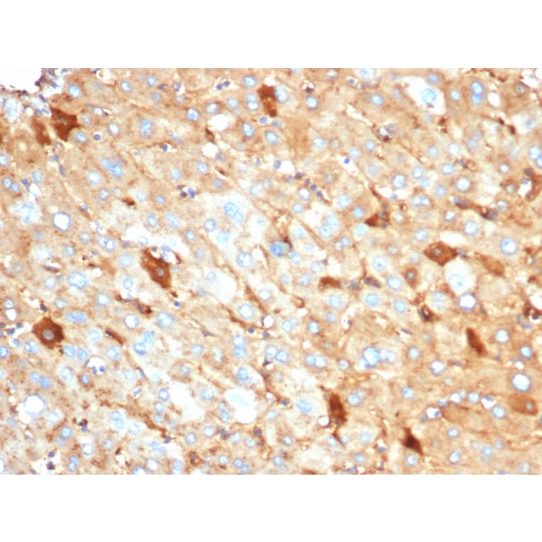 Immunohistochemistry - Anti-Albumin Antibody [rALB/6410] - BSA and Azide free (A251676) - Antibodies.com