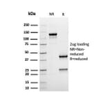 SDS-PAGE - Anti-Albumin Antibody [rALB/6410] - BSA and Azide free (A251677) - Antibodies.com