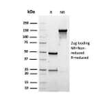 SDS-PAGE - Anti-Albumin Antibody [rALB/6412] - BSA and Azide free (A251678) - Antibodies.com