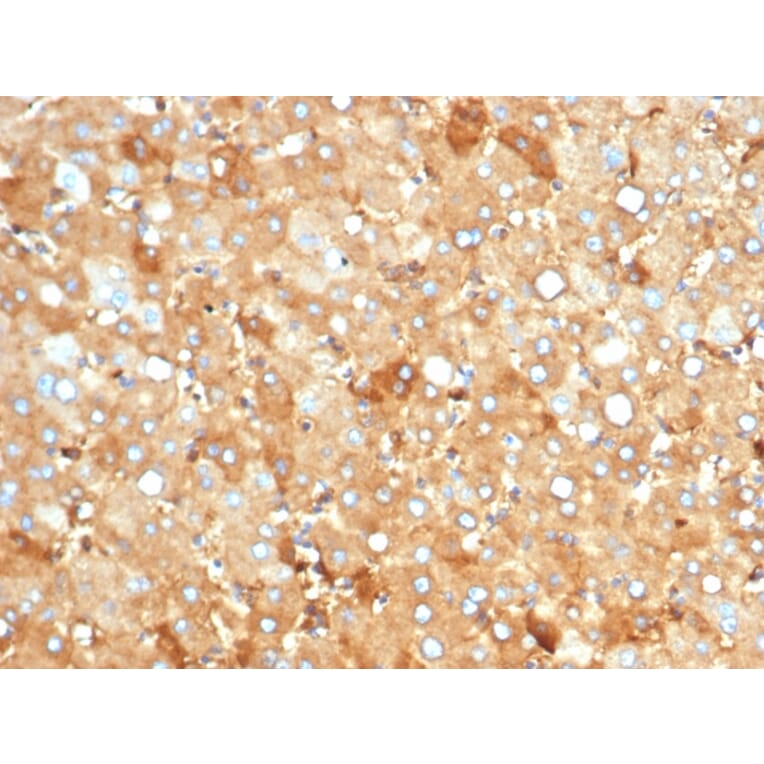 Immunohistochemistry - Anti-Albumin Antibody [rALB/6412] - BSA and Azide free (A251677) - Antibodies.com