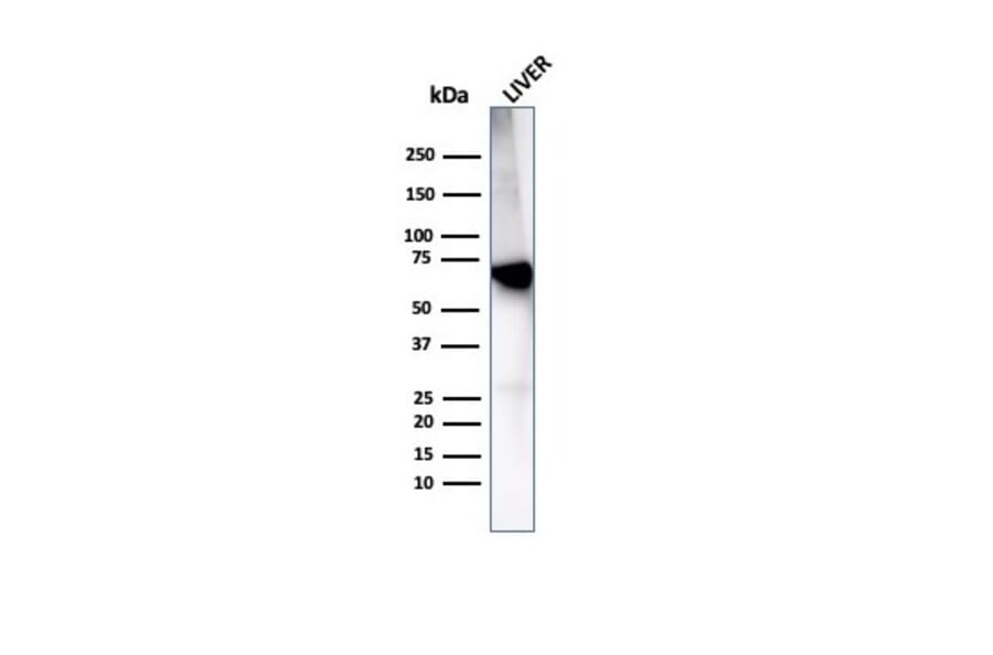Western Blot - Anti-Albumin Antibody [rALB/6414] - BSA and Azide free (A251679) - Antibodies.com