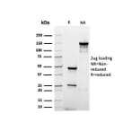 SDS-PAGE - Anti-Albumin Antibody [rALB/6414] - BSA and Azide free (A251679) - Antibodies.com