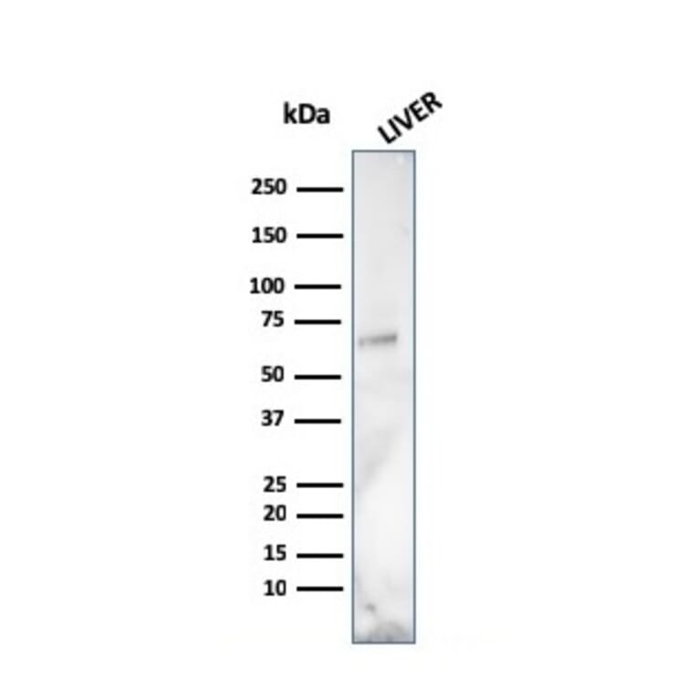 Western Blot - Anti-Albumin Antibody [ALB/2141] - BSA and Azide free (A251680) - Antibodies.com