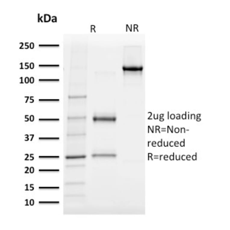 SDS-PAGE - Anti-Albumin Antibody [ALB/2142] - BSA and Azide free (A251681) - Antibodies.com