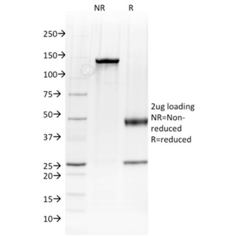 SDS-PAGE - Anti-Albumin Antibody [ALB/2144] - BSA and Azide free (A251682) - Antibodies.com