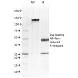 SDS-PAGE - Anti-Albumin Antibody [ALB/2144] - BSA and Azide free (A251682) - Antibodies.com