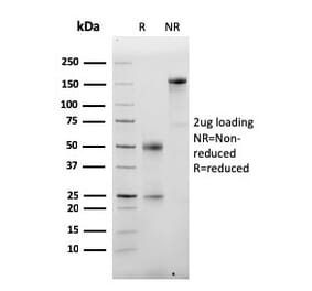 SDS-PAGE - Anti-Albumin Antibody [ALB/2355] - BSA and Azide free (A251683) - Antibodies.com