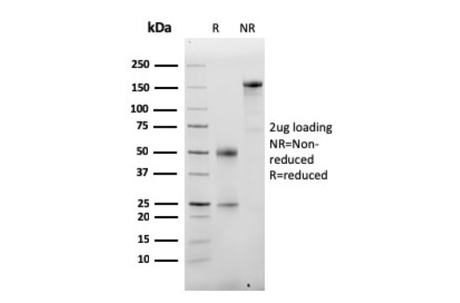 SDS-PAGE - Anti-Albumin Antibody [ALB/2355] - BSA and Azide free (A251683) - Antibodies.com