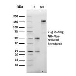 SDS-PAGE - Anti-Albumin Antibody [ALB/2355] - BSA and Azide free (A251683) - Antibodies.com