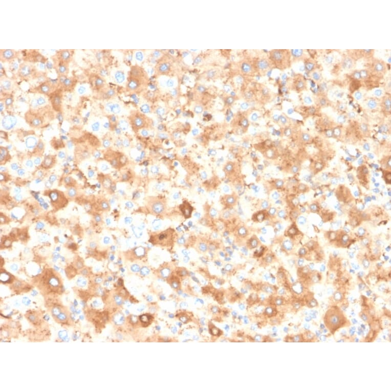 Immunohistochemistry - Anti-Albumin Antibody [ALB/2355] - BSA and Azide free (A251683) - Antibodies.com