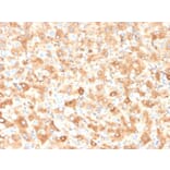 Immunohistochemistry - Anti-Albumin Antibody [ALB/2355] - BSA and Azide free (A251683) - Antibodies.com