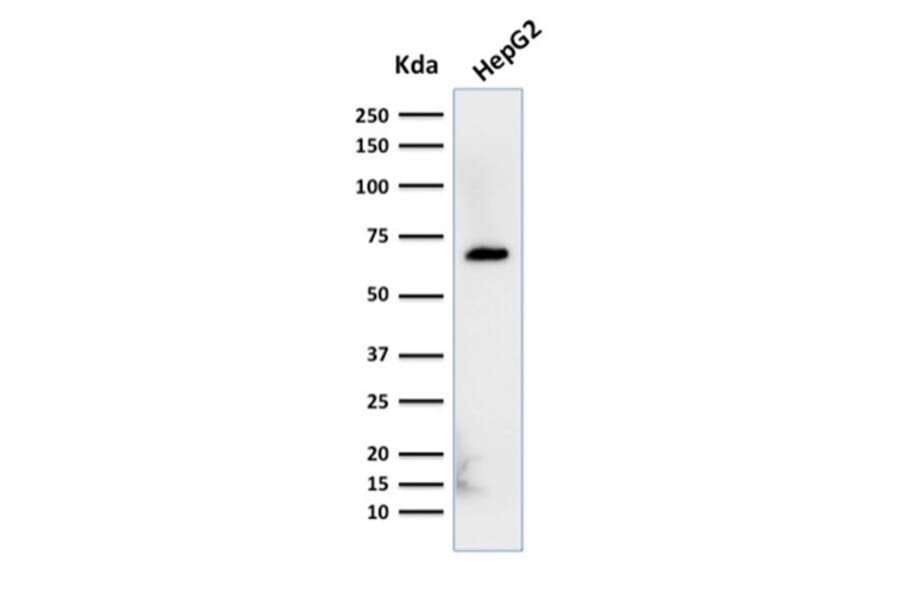 Western Blot - Anti-Albumin Antibody [ALB/2356] - BSA and Azide free (A251684) - Antibodies.com