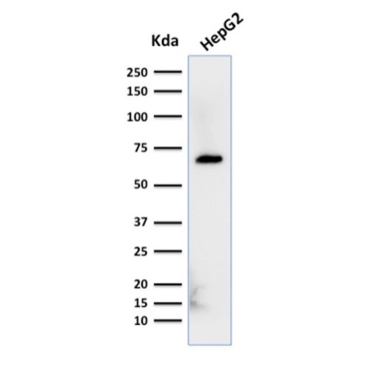 Western Blot - Anti-Albumin Antibody [ALB/2356] - BSA and Azide free (A251684) - Antibodies.com