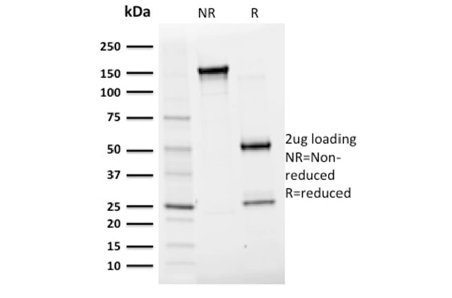 SDS-PAGE - Anti-Albumin Antibody [ALB/2356] - BSA and Azide free (A251684) - Antibodies.com