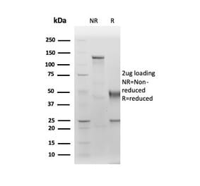 SDS-PAGE - Anti-Albumin Antibody [ALB/6411R] - BSA and Azide free (A251685) - Antibodies.com