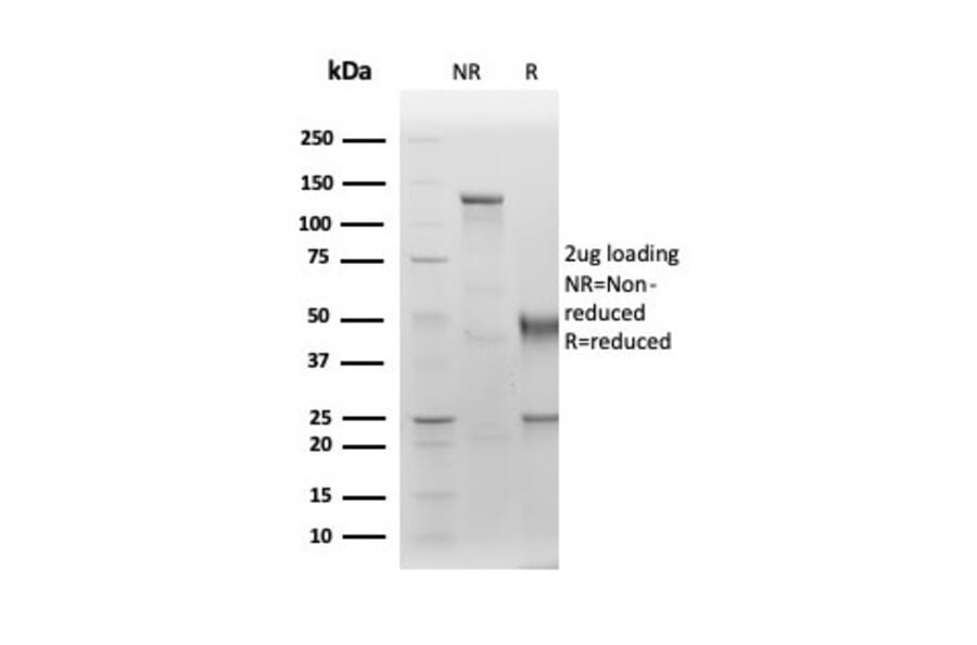 SDS-PAGE - Anti-Albumin Antibody [ALB/6411R] - BSA and Azide free (A251685) - Antibodies.com
