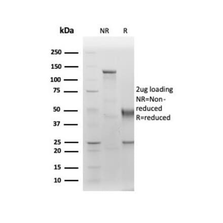 SDS-PAGE - Anti-Albumin Antibody [ALB/6411R] - BSA and Azide free (A251685) - Antibodies.com