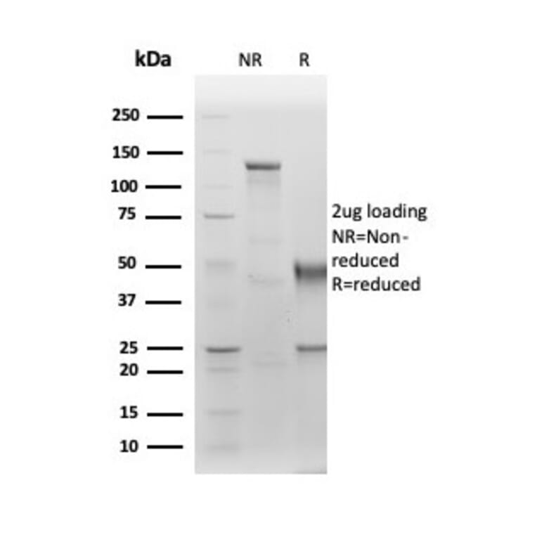 SDS-PAGE - Anti-Albumin Antibody [ALB/6411R] - BSA and Azide free (A251685) - Antibodies.com