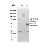 SDS-PAGE - Anti-Albumin Antibody [ALB/6411R] - BSA and Azide free (A251685) - Antibodies.com