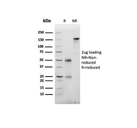 SDS-PAGE - Anti-Albumin Antibody [ALB/6413R] - BSA and Azide free (A251686) - Antibodies.com