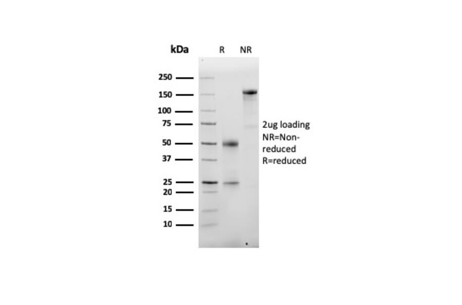 SDS-PAGE - Anti-Albumin Antibody [ALB/6413R] - BSA and Azide free (A251686) - Antibodies.com