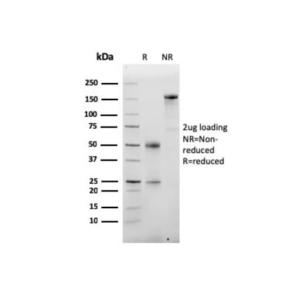 SDS-PAGE - Anti-Albumin Antibody [ALB/6413R] - BSA and Azide free (A251686) - Antibodies.com