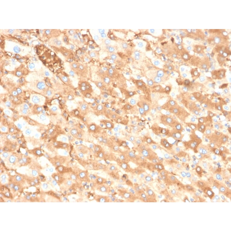 Immunohistochemistry - Anti-Albumin Antibody [ALB/6413R] - BSA and Azide free (A251686) - Antibodies.com
