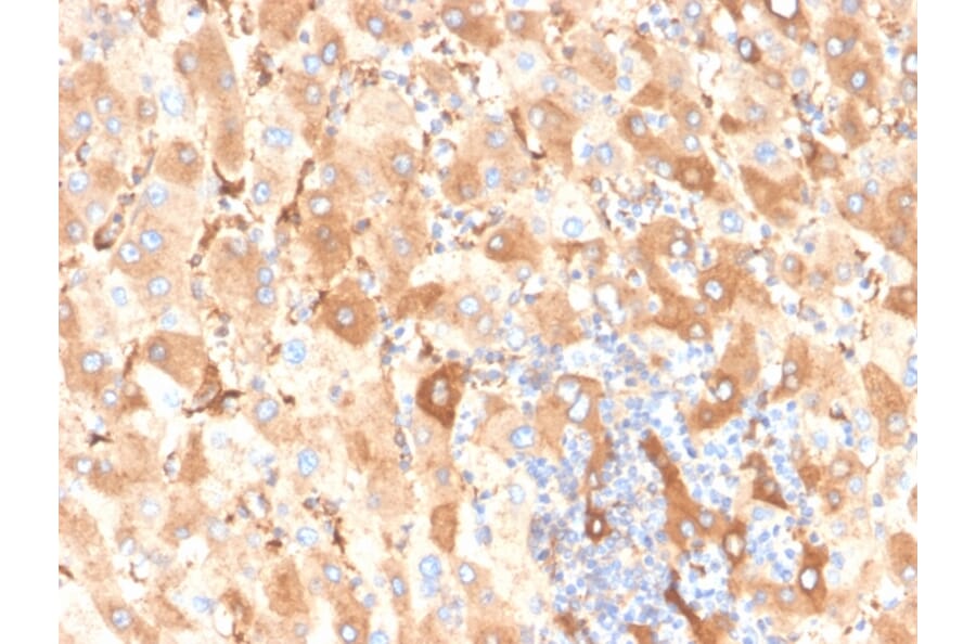 Immunohistochemistry - Anti-Albumin Antibody [ALB/6409R] - BSA and Azide free (A251686) - Antibodies.com