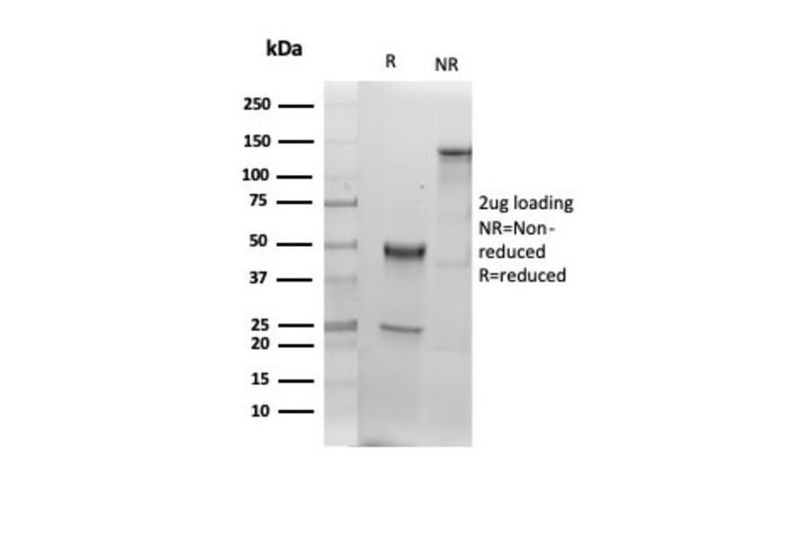 SDS-PAGE - Anti-Albumin Antibody [ALB/6409R] - BSA and Azide free (A251687) - Antibodies.com