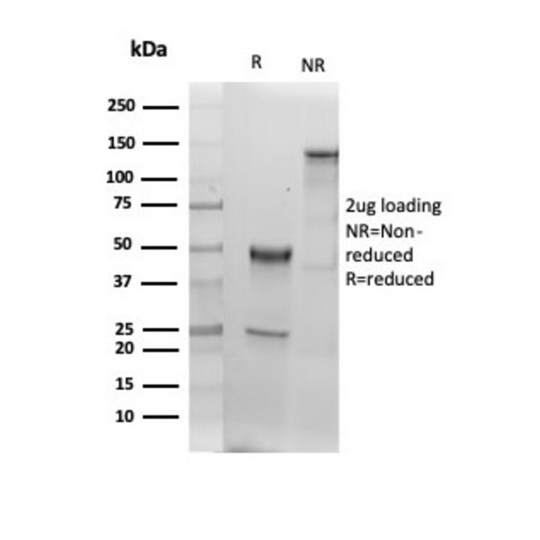 SDS-PAGE - Anti-Albumin Antibody [ALB/6409R] - BSA and Azide free (A251687) - Antibodies.com