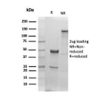 SDS-PAGE - Anti-Albumin Antibody [ALB/6409R] - BSA and Azide free (A251687) - Antibodies.com
